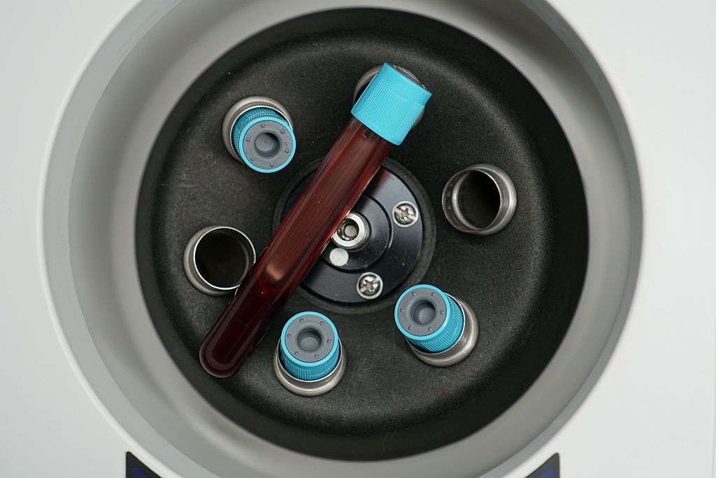 Putting a test tube with blood into centrifuge