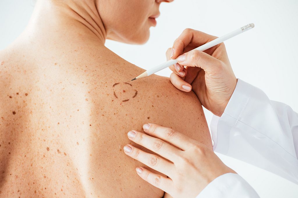cropped view of dermatologist applying marks on skin of naked woman with melanoma isolated on white