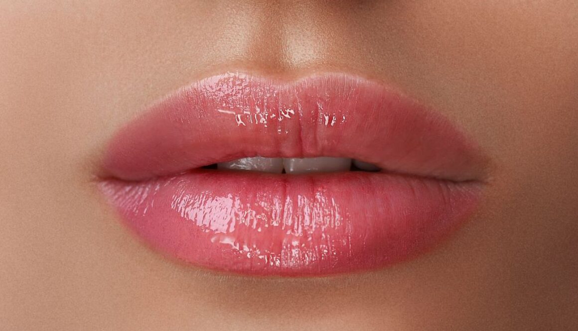 Kiedy lip lift daje lepszy efekt niż wypełnianie ust