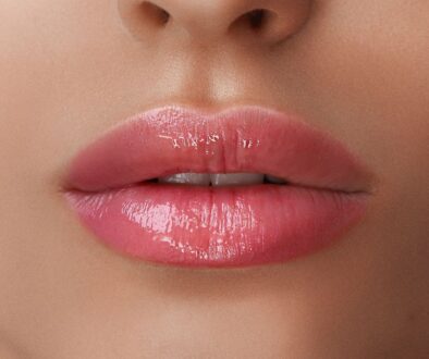 Kiedy lip lift daje lepszy efekt niż wypełnianie ust